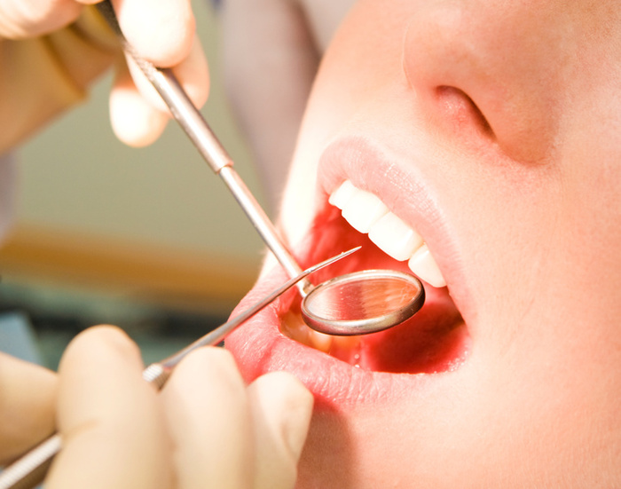 Finding A Dentist In Mankato MN