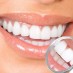 Benefits of Teeth Sealants in Vancouver, WA