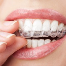 Straighten Your Teeth With Invisalign In Bayside, NY