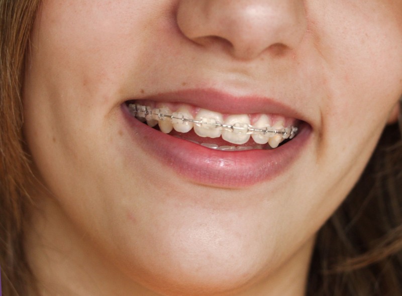 The General Dentists in Canyon Texas Want You to Eat a Healthy Diet