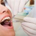 Is a Dental Implant a Better Choice?