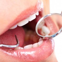 Signs it’s Time to Find a Periodontic Service in California, MD for Treatment of Gum Disease