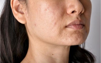 Turn Back the Clock and Reclaim Your Energy: The Anti-Aging Effect of IV Therapy in Miami Beach, FL
