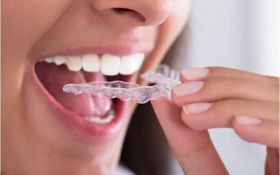 Transform Your Smile with Dental Bridges in Downers Grove Expertise